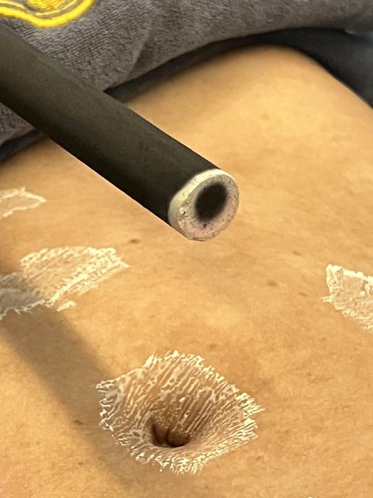 The moxa stick stays above the skin