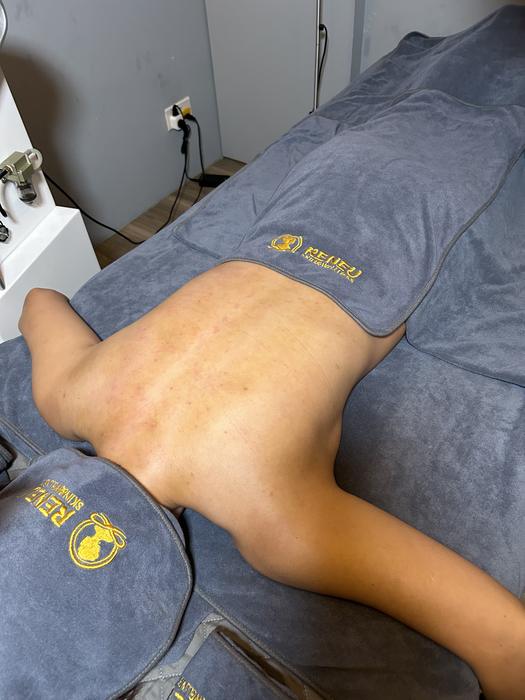 A back after a Bojin session, with light sha marks